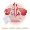 Adaptador para lavagem nasal Soniclear Nozzle - Image 4
